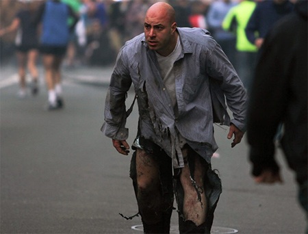 Một người đàn ông bị ảnh hưởng của vụ nổ làm rách nát quần áo