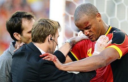 Máu vương khắp mặt của trung vệ người Bỉ