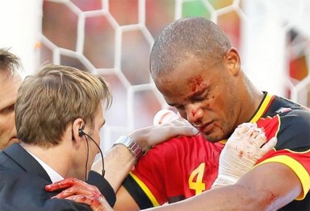 Kompany có phần bị choáng