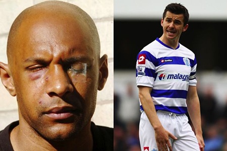 Dabo với những vết thương từ vụ tấn công của Barton