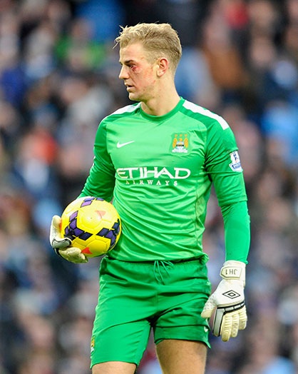 Hâu quả anh bị vết rách khá nguy hiểm ở gần mắt khi đầu gối đối phương đập vào