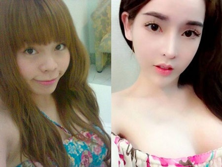Những ca phẫu thuật thẩm mỹ thành công của Dr.Kim - 1 Những ca phẫu thuật thẩm mỹ thành công của Dr.Kim