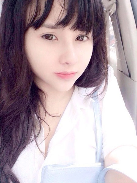 Những ca phẫu thuật thẩm mỹ thành công của Dr.Kim - 6 Trước thẩm mỹ Trang có nét mặt không mấy thon gọn