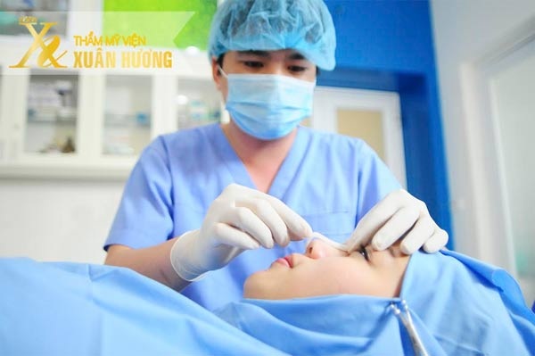 Nâng mũi S line cho dáng mũi cong chữ S mềm mại và đẹp hoàn
hảo