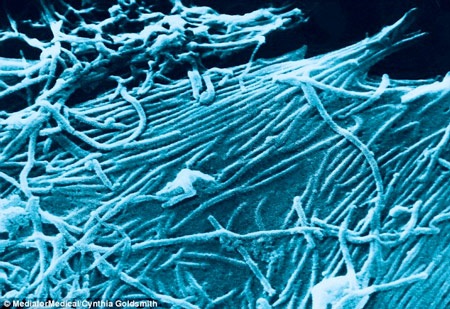 Vắc xin dạng xịt mũi - “Vũ khí” mới giúp ngăn chặn dịch Ebola - 1 Vi rút Ebola dưới kính hiển vi