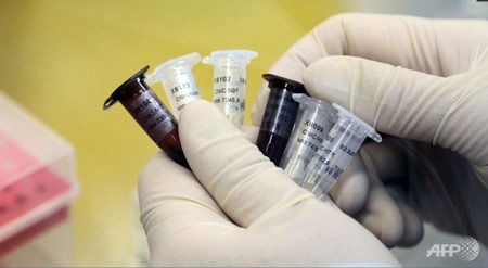 Canada bắt đầu các thử nghiệm vắc xin Ebola - 1 Canada bắt đầu các thử nghiệm vắc xin Ebola