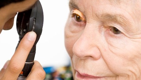 Mí mắt giật có phải do xui? - 2 Bạn nên gặp bác sĩ
khi thời gian mí mắt giật kéo dài