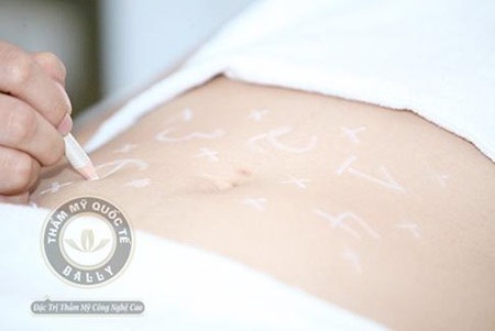 Cách giảm béo nhanh nhất chỉ sau 1 giờ đồng hồ - 3 Khuyến mại chỉ còn 2 triệu/điểm