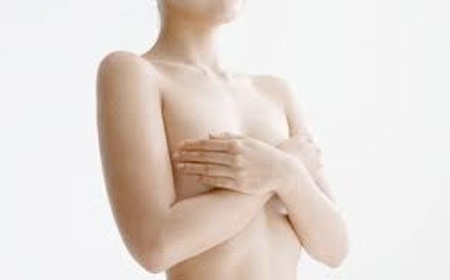 Cách đơn giản phòng ngừa ung thư vú hiệu quả - 1 Cách đơn giản phòng ngừa ung thư vú hiệu quả