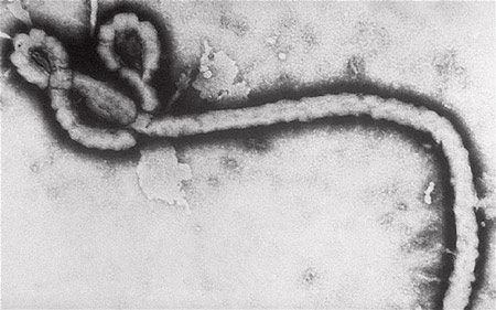 Nguy cơ lây nhiễm Ebola qua đường tình dục? - 1 Nguy cơ lây nhiễm Ebola qua đường tình dục?