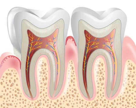Đã đến lúc phải quan tâm đến… nướu - 1 Nếu bị viêm nướu nặng, bạn có thể đối diện với nguy cơ mất
răng…vĩnh viễn