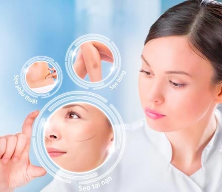 Sẹo không còn “bất trị” - 1 Sẹo không còn “bất trị”