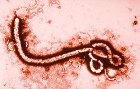 WHO khuyến cáo người khỏi Ebola kiêng sex trong 3 tháng - 1 WHO khuyến cáo người khỏi Ebola kiêng sex trong 3 tháng