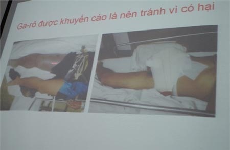 Bị rắn lục đuôi đỏ cắn, điều trị bằng thuốc Nam sẽ không có
hiệu quả