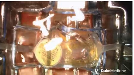 Những bước đột phá trong y học năm 2014 - 4 Người
mù nhìn được nhờ mắt phỏng sinh học