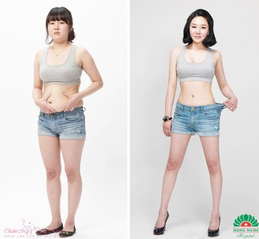 Chào mừng năm mới: Quà tặng làm đẹp da lên đến 30% - 2 Hotline: 0915.810.138 - 0915.810.134