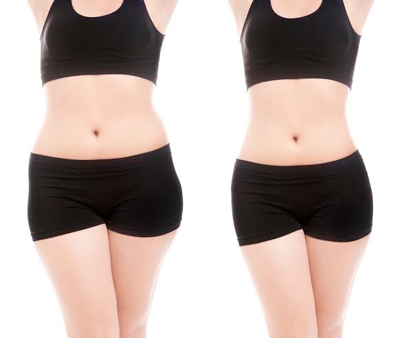 5 lưu ý cần biết trước khi giảm mỡ - 3 Chỉ sau một lần điều trị, mỡ thừa ở vòng eo đã được
xóa bỏ đến gần 95%.