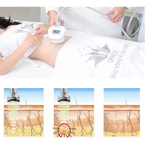 5 lưu ý cần biết trước khi giảm mỡ - 2 Mỡ thừa luôn tiềm ẩn nhiều nguy cơ bệnh tật nguy hiểm
về tim mạch, đái tháo