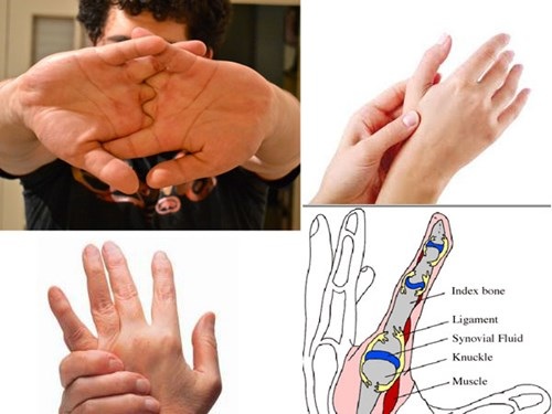 Hệ lụy từ thói quen bẻ khớp ngón tay - 1 Khoảng trống giữa các khớp giãn nở tạo ra tiếng răng rắc khi
bạn bẻ ngón tay
