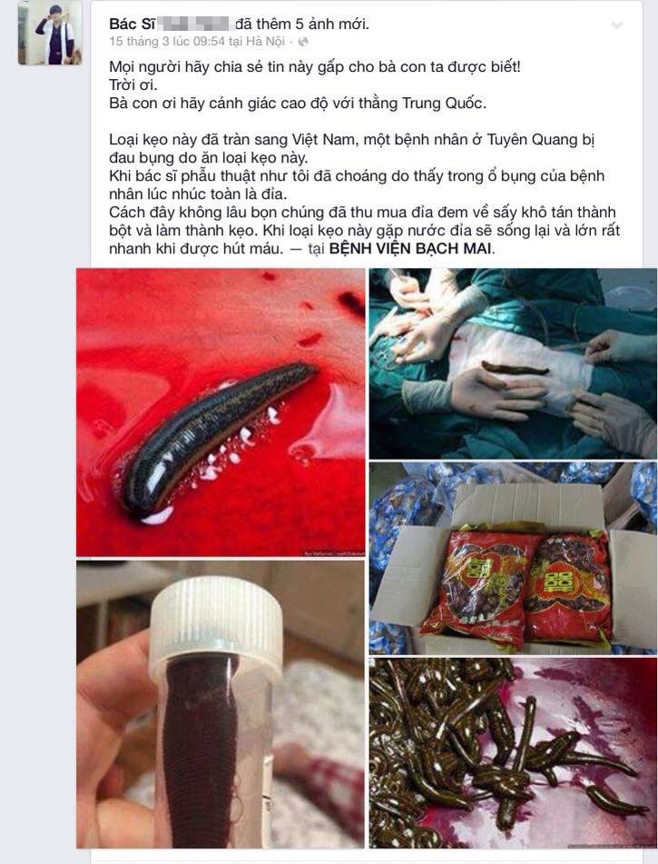 Thực hư ca phẫu thuật toàn đỉa tại bệnh viện Bạch Mai - 1 Những hình ảnh trên facebook T.N gây hoang mang dư luận