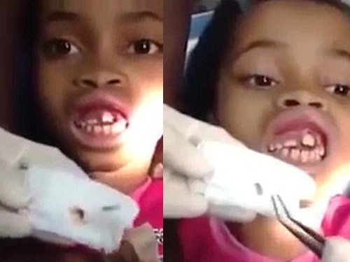 Mơ Thấy Giòi: Giải Mã Ý Nghĩa Và Điềm Báo Từ Giấc Mơ Đặc Biệt