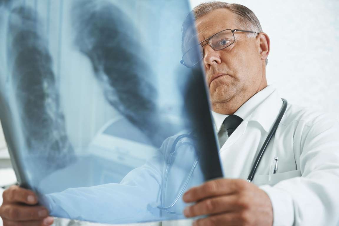 14 bệnh hay “sánh bước” cùng nhau - 3 11. & 12. COPD +
zona
