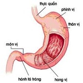 Phác đồ 4T dành cho bệnh viêm loét hang vị dạ dày - 1 Phác đồ 4T dành cho bệnh viêm loét hang vị dạ dày