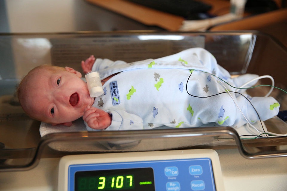 Hy hữu bé trai bẩm sinh không có mũi