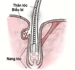 Những lưu ý quan trọng khi bị rụng tóc - 1 Tóc rụng xin đừng mất… nang tóc