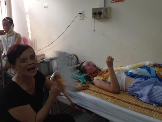 Chị
M. bị bỏng nặng do cồn nước gây ra