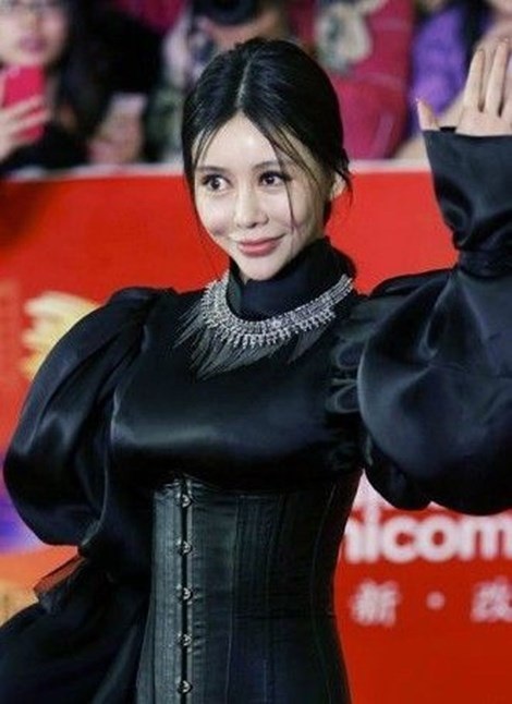 Hàng vạn người tàn phế vì giải phẫu thẩm mỹ - 2 Ngôi sao Củng Tân Lượng bị gọi là Xà tinh sau khi phẫu thuật
thẩm mỹ.