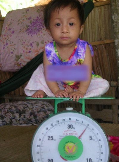 9 năm về trước, Trúc Ly chỉ nặng 3 kg, dù đã 5 tuổi. Ảnh:
Công Tuấn