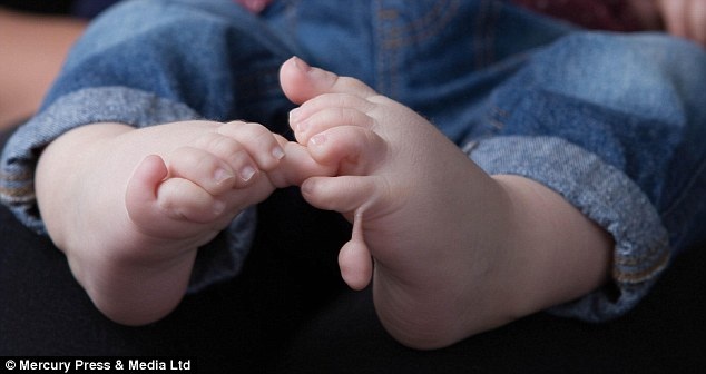Bé trai có 12 ngón tay và 12 ngón chân “đánh đố” các bác sĩ - 2 Bé trai có 12 ngón tay và 12 ngón chân “đánh đố” các bác sĩ