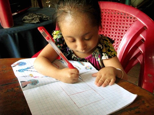 Bé Ly rất muốn được đi học nhưng vì ngại bị bạn bè chọc ghẹo
nên đành nghỉ ở nhà. Ảnh: Sông Hậu