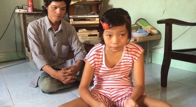 Cuộc sống như “hình nộm” của bé gái mắc bệnh lạ khiến chân tay co rút - 1 Cuộc sống như “hình nộm” của bé gái mắc bệnh lạ khiến chân tay co rút