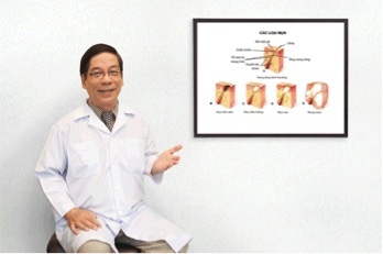 Những điều đơn giản nam giới cần biết về mụn - 1 Bác sĩ da liễu Huỳnh Huy Hoàng