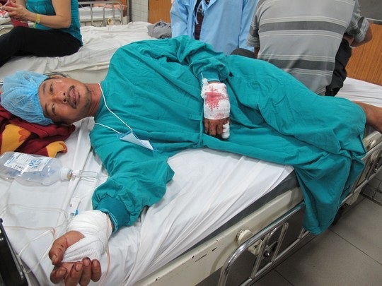 Khỉ đứt xích cắn nát hai bàn tay ông chủ - 1 Nạn nhân nhập viện trong tình trạng bị thương nặng 2 bàn tay