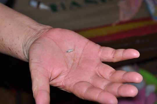 Phát hiện dòi trong tai trẻ sơ sinh - 2 Con dòi được gia đình gắp từ tai cháu bé. Ảnh do gia đình
cung cấp