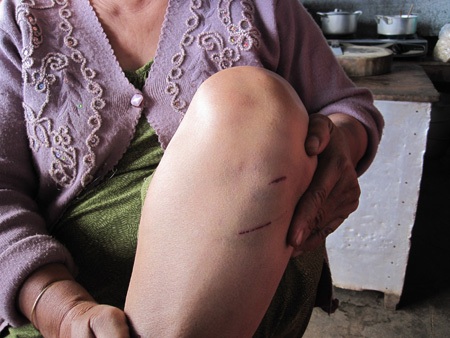 Con trai đánh mẹ bầm dập vì muốn chiếm nhà - 2