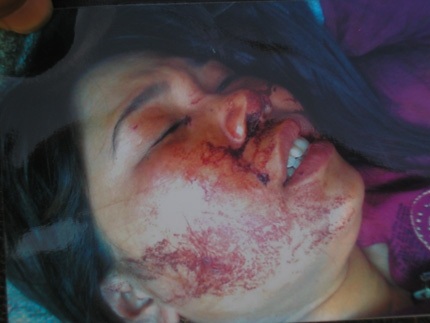 Khởi tố vụ vợ chủ tịch xã đánh ghen dã man