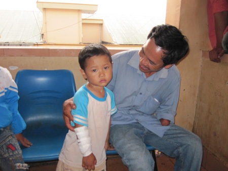 Bé trai 4 tuổi bị vỏ đạn nổ găm vào tay