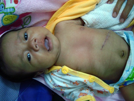 Bé gái Rơ Châm Nêm