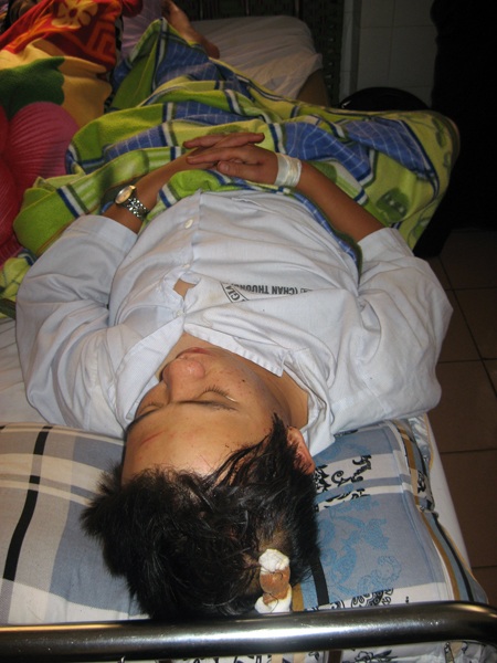 Vết thương ở đầu anh Thắng