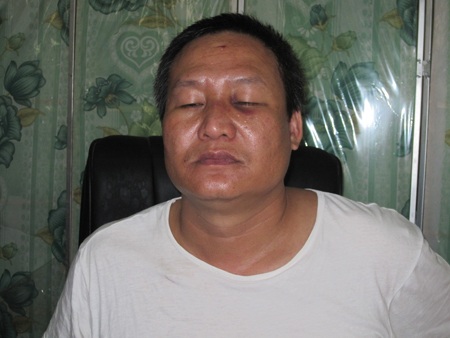 Ông Thắng bị dập sống mũi sau khi bị hành hung