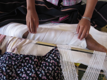 Con gái bà Jũng chỉ đoạn vết thương đã bị hoại tử và cắt bỏ của mẹ mình