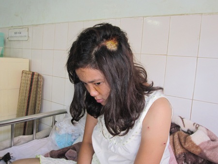 Trân với các vết thương trên cơ thể