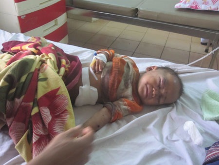 Cháu Minh bị thương đang điều trị tại BV tỉnh Gia Lai