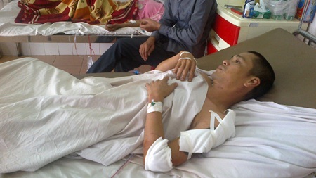 Bỗng dưng bị đâm nhiều nhát vào người - 1 Anh Đại kể lại sự việc mình vô cớ bị đâm