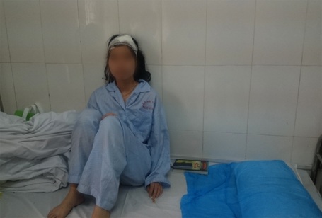 Nữ sinh Nguyễn Thùy Linh bị khâu 10 mũi sau khi bị mảng vữa rơi vào đầu.