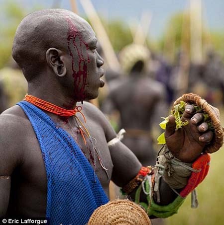Rùng mình với những cuộc thi đấu đẫm máu ở Châu Phi - 4 Cảnh máu chảy và thương tật là chuyện thường thấy sau mỗi cuộc thi